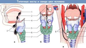 Симптомы боковой кисты шеи (жаберной кисты) и ее лечение Срединный свищ шеи мкб 10